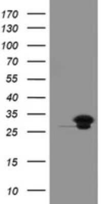 Western Blot: UBE2S Antibody (OTI1B5) [NBP2-46279]