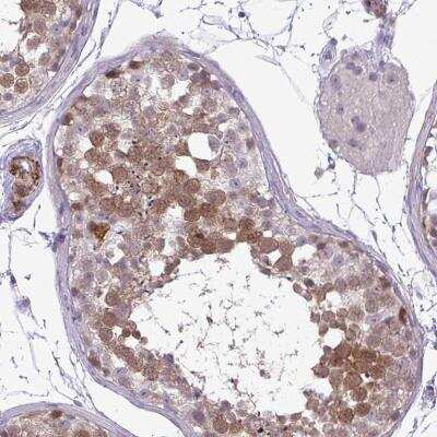 Immunohistochemistry-Paraffin: UBE2S Antibody [NBP2-38822]