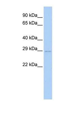 Western Blot: UBE2S Antibody [NBP1-55056]