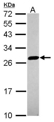 Western Blot: UBE2S Antibody [NBP2-20788]