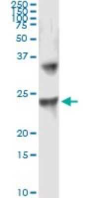 Immunoprecipitation: UBE2T Antibody (1E12-4A3) [H00029089-M01]