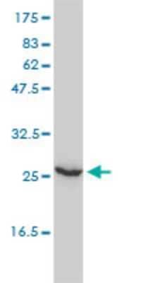 Western Blot: UBE2T Antibody (1E12-4A3) [H00029089-M01]