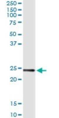Immunoprecipitation: UBE2T Antibody (2A12-4F11) [H00029089-M03]
