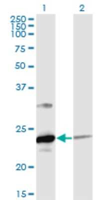 Western Blot: UBE2T Antibody (4G1-4C2) [H00029089-M02]