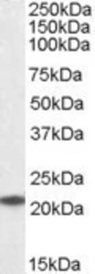 Western Blot: UBE2T Antibody [NB100-1150]