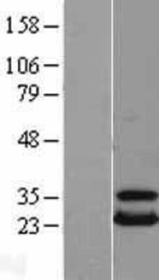 Western Blot: UBE2T Overexpression Lysate [NBL1-17545]