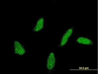 Immunocytochemistry/ Immunofluorescence: UBE2U Antibody (3D4) [H00148581-M07]