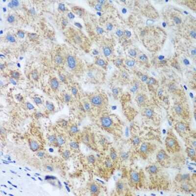 Immunohistochemistry-Paraffin: UBE2U Antibody - BSA Free [NBP2-94609]