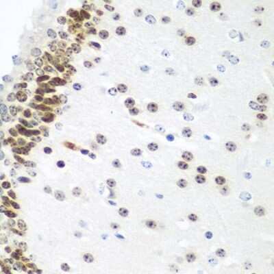 Immunohistochemistry-Paraffin: UBE2U Antibody - BSA Free [NBP2-94609]