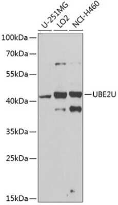 Western Blot: UBE2U AntibodyBSA Free [NBP2-94609]