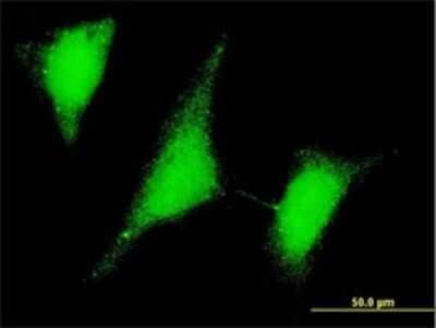 Immunocytochemistry/ Immunofluorescence: UBE2W Antibody (7G4) [H00055284-M01]