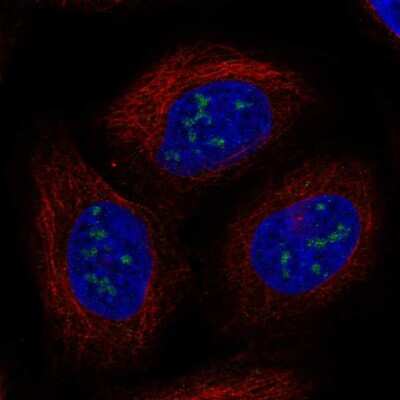 Immunocytochemistry/ Immunofluorescence: UBE2W Antibody [NBP2-57789]