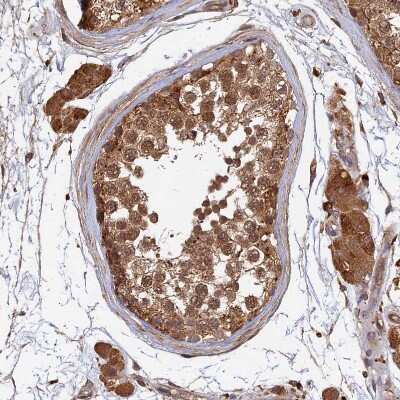 Immunohistochemistry-Paraffin: UBE2W Antibody [NBP1-92558]
