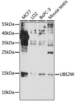 Western Blot: UBE2W AntibodyAzide and BSA Free [NBP2-94761]