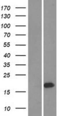 Western Blot: UBE2W Overexpression Lysate [NBP2-09080]