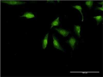 Immunocytochemistry/ Immunofluorescence: UBE2Z Antibody (4B1) [H00065264-M01]