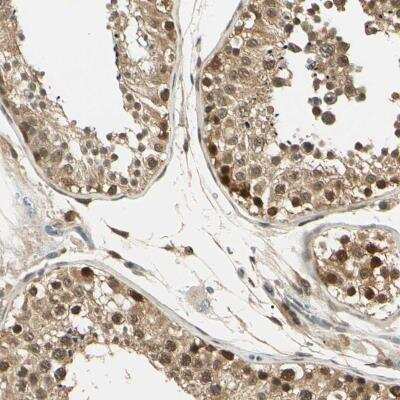 Immunohistochemistry-Paraffin: UBE2Z Antibody [NBP1-82245]