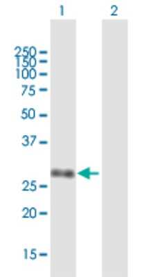 Western Blot: UBE2Z Antibody [H00065264-B01P]