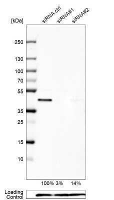 Western Blot: UBE2Z Antibody [NBP1-82245]