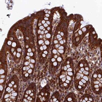 Immunohistochemistry-Paraffin: UBE3B Antibody [NBP1-92559]