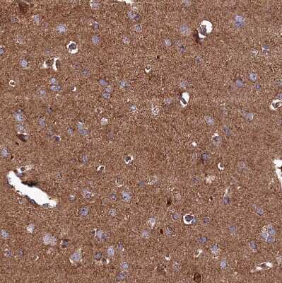 Immunohistochemistry-Paraffin: UBE3B Antibody [NBP1-92559]