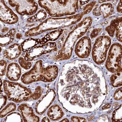 Immunohistochemistry-Paraffin: UBE3B Antibody [NBP1-92559]