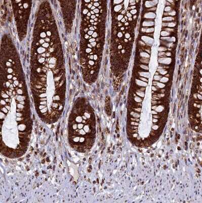 Immunohistochemistry-Paraffin: UBE3B Antibody [NBP1-92559]