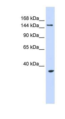 Western Blot: UBE3B Antibody [NBP1-54950]