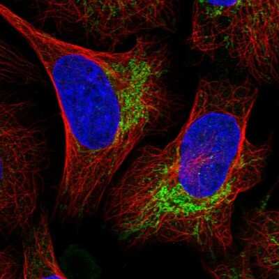 Immunocytochemistry/ Immunofluorescence: UBE3C Antibody [NBP1-81558]