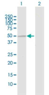 Western Blot: UBE3C Antibody [H00009690-D01P]