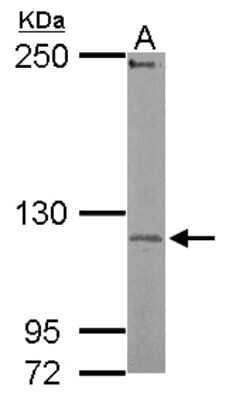 Western Blot: UBE3C Antibody [NBP2-20790]