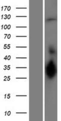 Western Blot: UBE3C Overexpression Lysate [NBP2-07298]