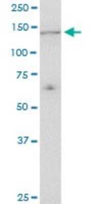 Western Blot: UBE4A Antibody (1G8) [H00009354-M08]