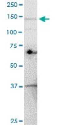 Western Blot: UBE4A Antibody (1G8) [H00009354-M08]