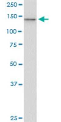 Western Blot: UBE4A Antibody (1G8) [H00009354-M08]