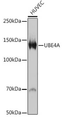 Western Blot: UBE4A Antibody (2A5N2) [NBP3-15300]