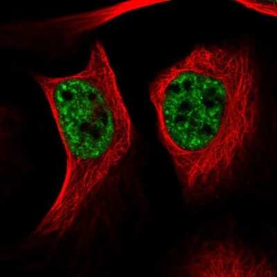 Immunocytochemistry/ Immunofluorescence: UBE4A Antibody [NBP2-47590]