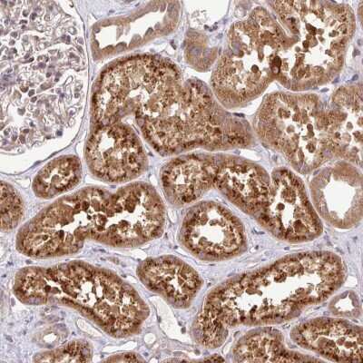 Immunohistochemistry: UBE4A Antibody [NBP2-47590]