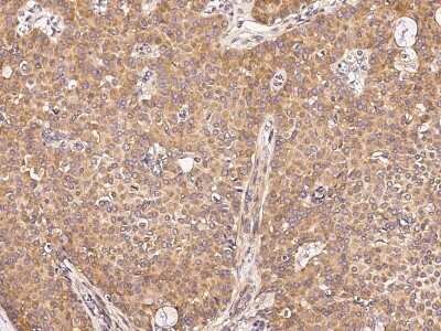 Immunohistochemistry-Paraffin: UBE4A Antibody [NBP2-98835]