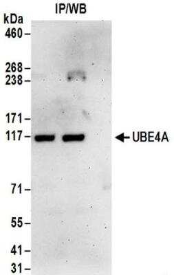 Immunoprecipitation: UBE4A Antibody [NBP2-32199]