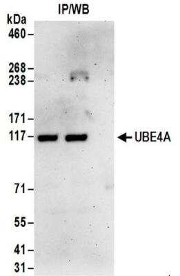 Immunoprecipitation: UBE4A Antibody [NBP2-32200]