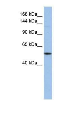 Western Blot: UBE4A Antibody [NBP1-55038]