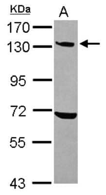 Western Blot: UBE4A Antibody [NBP2-20791]