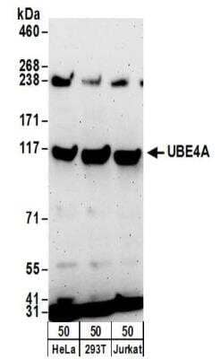 Western Blot: UBE4A Antibody [NBP2-32200]