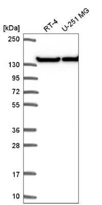 Western Blot: UBE4A Antibody [NBP2-56653]