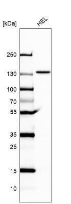 Western Blot: UBE4A Antibody [NBP2-56653]