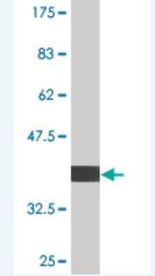 Western Blot: UBE4B Antibody (1D5) [H00010277-M02]