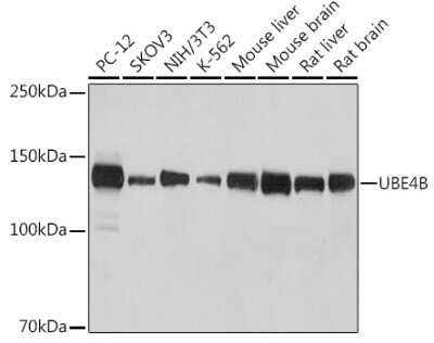 Western Blot: UBE4B Antibody (1D7K5) [NBP3-15263]