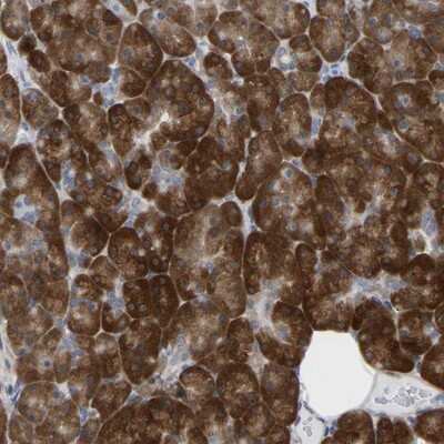 Immunohistochemistry-Paraffin: UBE4B Antibody [NBP1-84943]