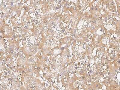 Immunohistochemistry-Paraffin: UBE4B Antibody [NBP2-98954]